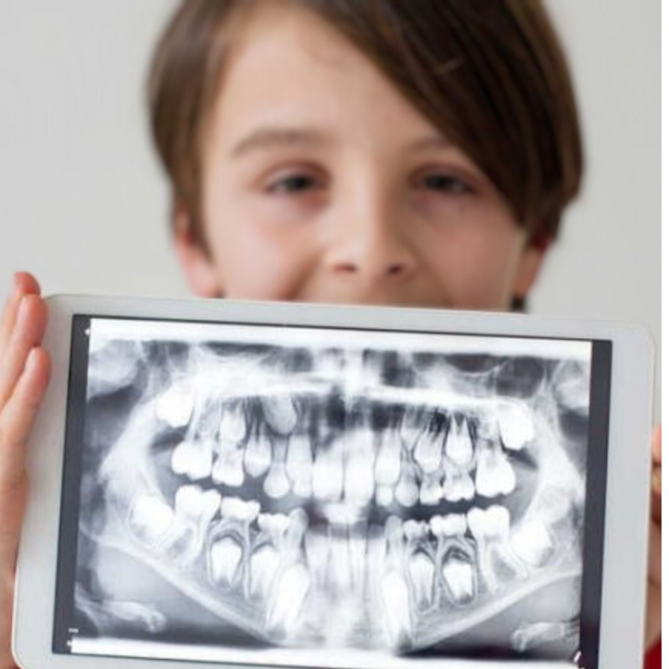 Son seguras las radiografías dentales en niños Clínica dental Gobela